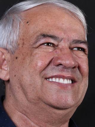 PRÓTESE TOTAL FIXA EM IMPLANTES de C.A.