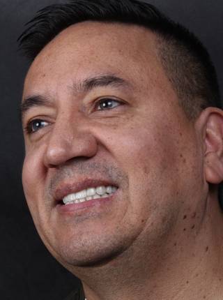 LENTES DE CONTATO DENTAIS EM PORCELANA de R.E.A.L