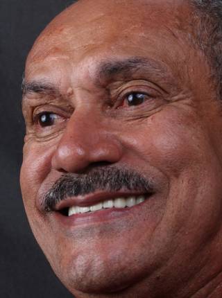 PRÓTESE TOTAL FIXA EM IMPLANTES de M.D.D.S