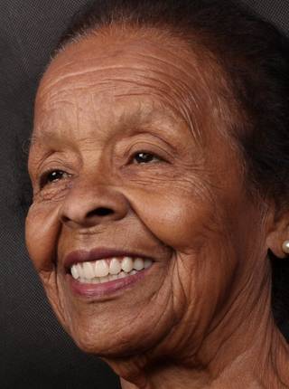 PRÓTESE TOTAL FIXA EM IMPLANTES de V.D.A.M.