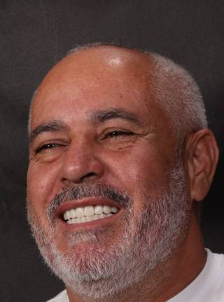 PRÓTESE TOTAL FIXA EM IMPLANTES de S.M.A.