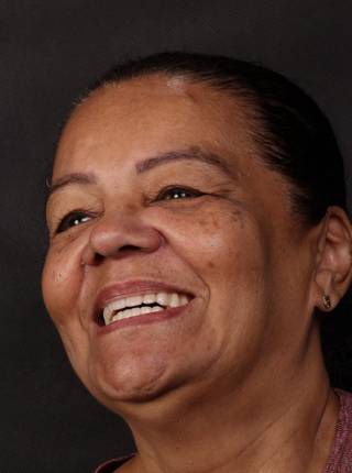 PRÓTESE TOTAL FIXA EM IMPLANTES de E.G.D.L.D.