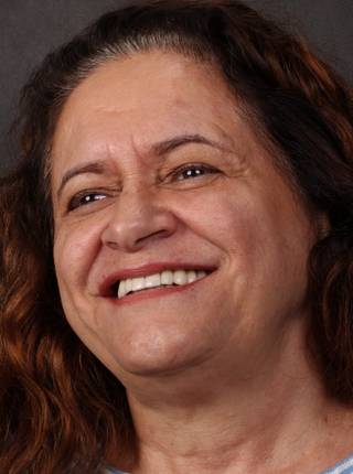 PRÓTESE TOTAL FIXA EM IMPLANTES de E.M.D.C