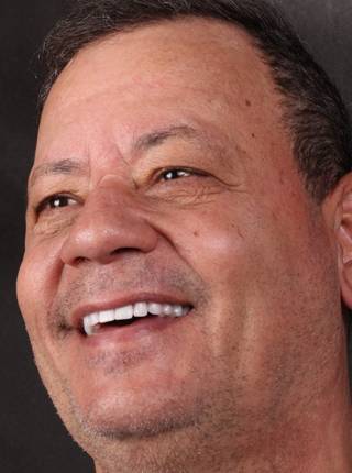 PRÓTESE TOTAL FIXA EM IMPLANTES de C.P.F.