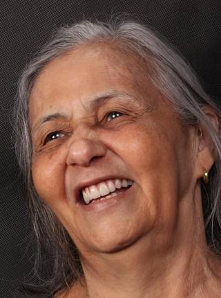 PRÓTESE TOTAL FIXA EM IMPLANTES de J.M.L.S