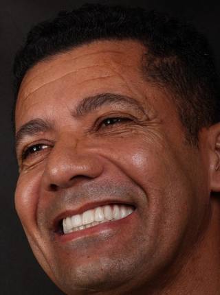 PRÓTESE TOTAL FIXA EM IMPLANTES de C.B.D.S.