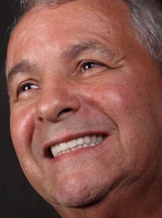 PRÓTESE TOTAL FIXA EM IMPLANTES de A.B.D.S.