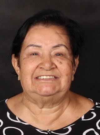 PRÓTESE TOTAL FIXA EM IMPLANTES de Z.B.D.A.