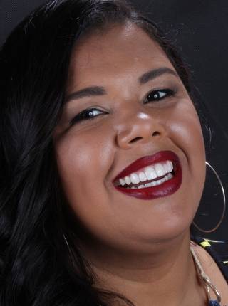 LENTES DE CONTATO DENTAIS EM PORCELANA de R.S.N.