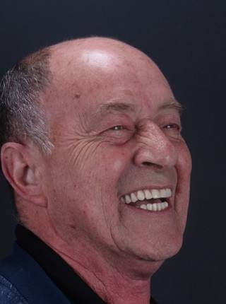 PRÓTESE TOTAL FIXA EM IMPLANTES de J.A.B.