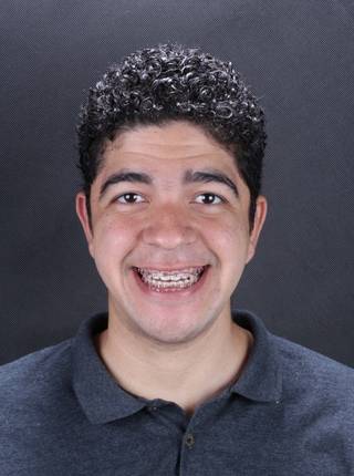 ORTODONTIA  de F.H.P.F. (Cirurgia Ortognática) - Em tratamento