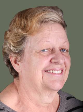 PRÓTESE TOTAL FIXA EM IMPLANTES de S.R.M.F