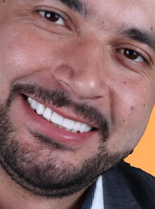 LENTES DE CONTATO DENTAIS EM PORCELANA de A.M.C.