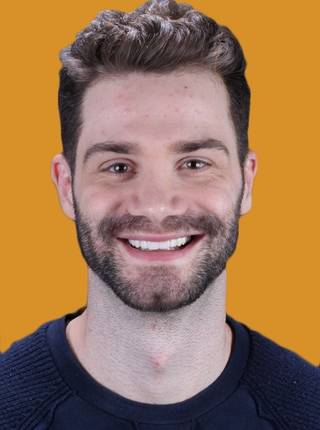 LENTES DE CONTATO DENTAIS EM PORCELANA de M.S.R.