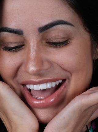 LENTES DE CONTATO DENTAIS EM PORCELANA de L.S.L.