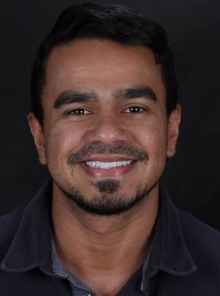 LENTES DE CONTATO DENTAIS EM PORCELANA de E.A.A.L.J.