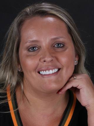 LENTES DE CONTATO DENTAIS EM PORCELANA de M.M.N.