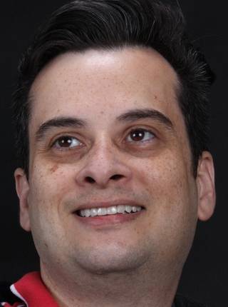 LENTES DE CONTATO DENTAIS EM PORCELANA de D.H.O.