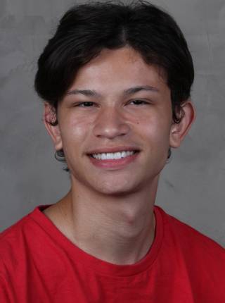 LENTES DE CONTATO DENTAIS EM PORCELANA de G.L.