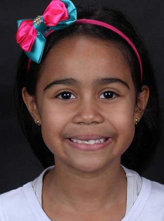 ORTODONTIA MIOFUNCIONAL de V.R.C.