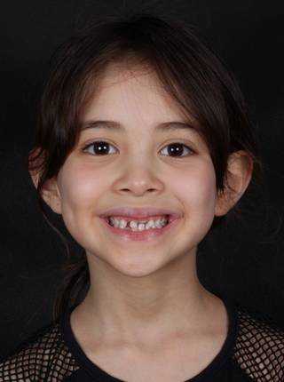 ORTODONTIA MIOFUNCIONAL de N.A.M. 