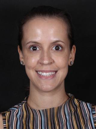 INVISALIGN de J.C.P.