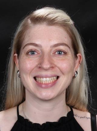 INVISALIGN de J.R.R.G.