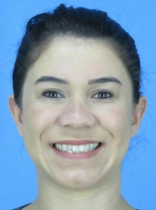 INVISALIGN de S.S.G.