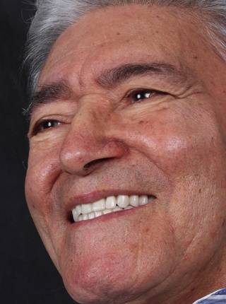 PRÓTESE TOTAL FIXA EM IMPLANTES de A.E.F.