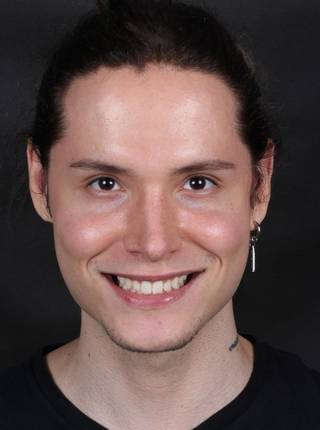 INVISALIGN de L.F.S.P.