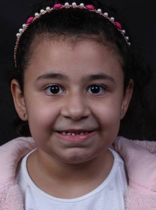 ORTODONTIA MIOFUNCIONAL de R.P.B.