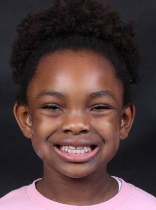 ORTODONTIA MIOFUNCIONAL de M.N.P.C.