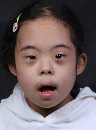 ORTODONTIA MIOFUNCIONAL de J.Y.B.K.