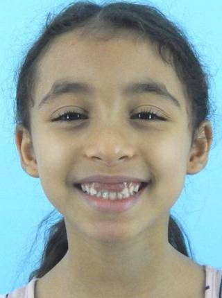 ORTODONTIA MIOFUNCIONAL de J.N.E.