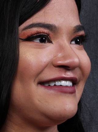 LENTES DE CONTATO DENTAIS EM PORCELANA de J.Y.T.G.