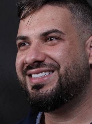 LENTES DE CONTATO DENTAIS EM PORCELANA de B.O.R.S.