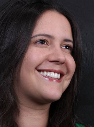 LENTES DE CONTATO DENTAIS EM PORCELANA de R.S.A.