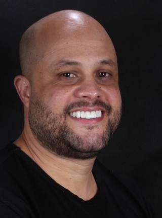 LENTES DE CONTATO DENTAIS EM PORCELANA de A.J.S.