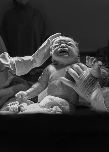 fotografia de parto de A chegada do Arthur