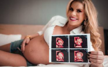 Ansiedade na gravidez: Como a ansiedade pode me afetar e 4 dicas para lidar com a ansiedade na gestação