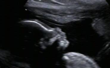 Orientações para ensaio Algodão Doce (recém-nascido)