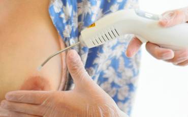 Conheça os benefícios do Laser na amamentação 