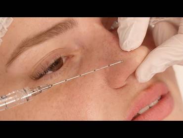 Gravação de Cursos de Dra Ariane Turcantel - Rinomodelação | Curso Online