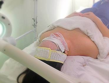 Estética Facial de Limpeza de Pele Profunda