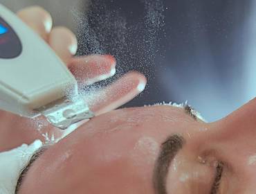 Estética Facial de Peeling Mecânico