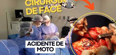 Reclamações na Zona Oeste de Cirurgia na face