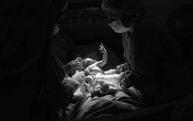 O que é fotografia de parto?