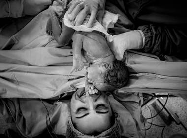 Parto de Nascimento do Bernardo