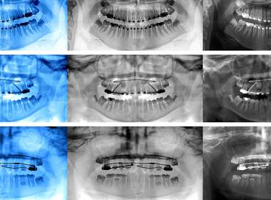 Radiografia Panoramica de Radiografia Panoramica