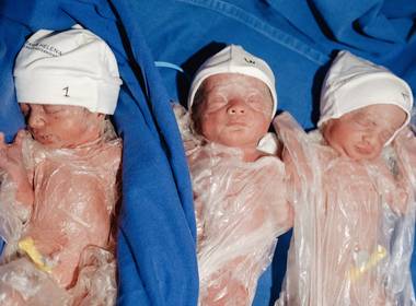Nascimentos de O nascimento da Aurora, Luisa e Laura - Trigêmeas
